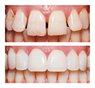 Cosmetic Dentistry